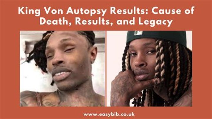 King Von Cause of Death: A Comprehensive Overview