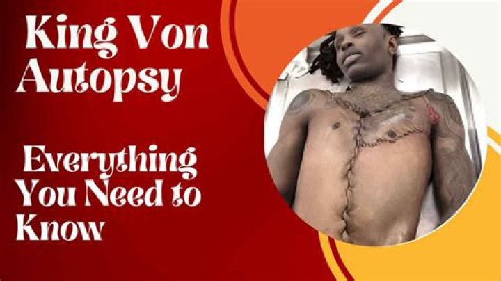 Understanding King Von's Autopsy: A Deep Dive into the Circumstances and Implications